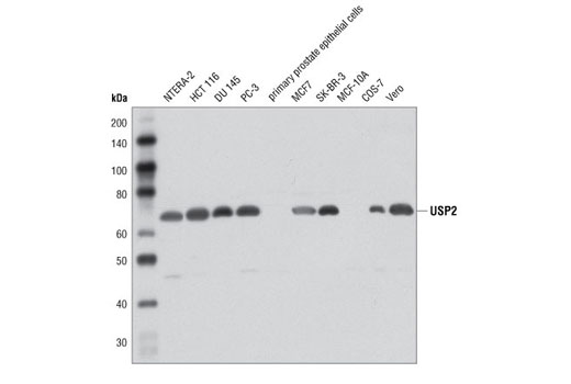 Western Blotting Image 1: USP2 Antibody
