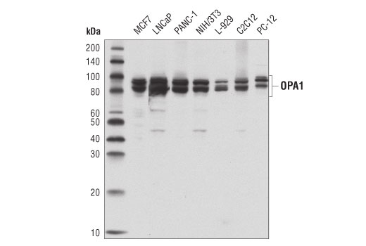  Image 26: Mitochondrial Dynamics Antibody Sampler Kit
