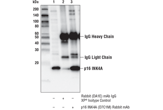 Immunoprecipitation Image 1: p16 INK4A (D7C1M) Rabbit mAb