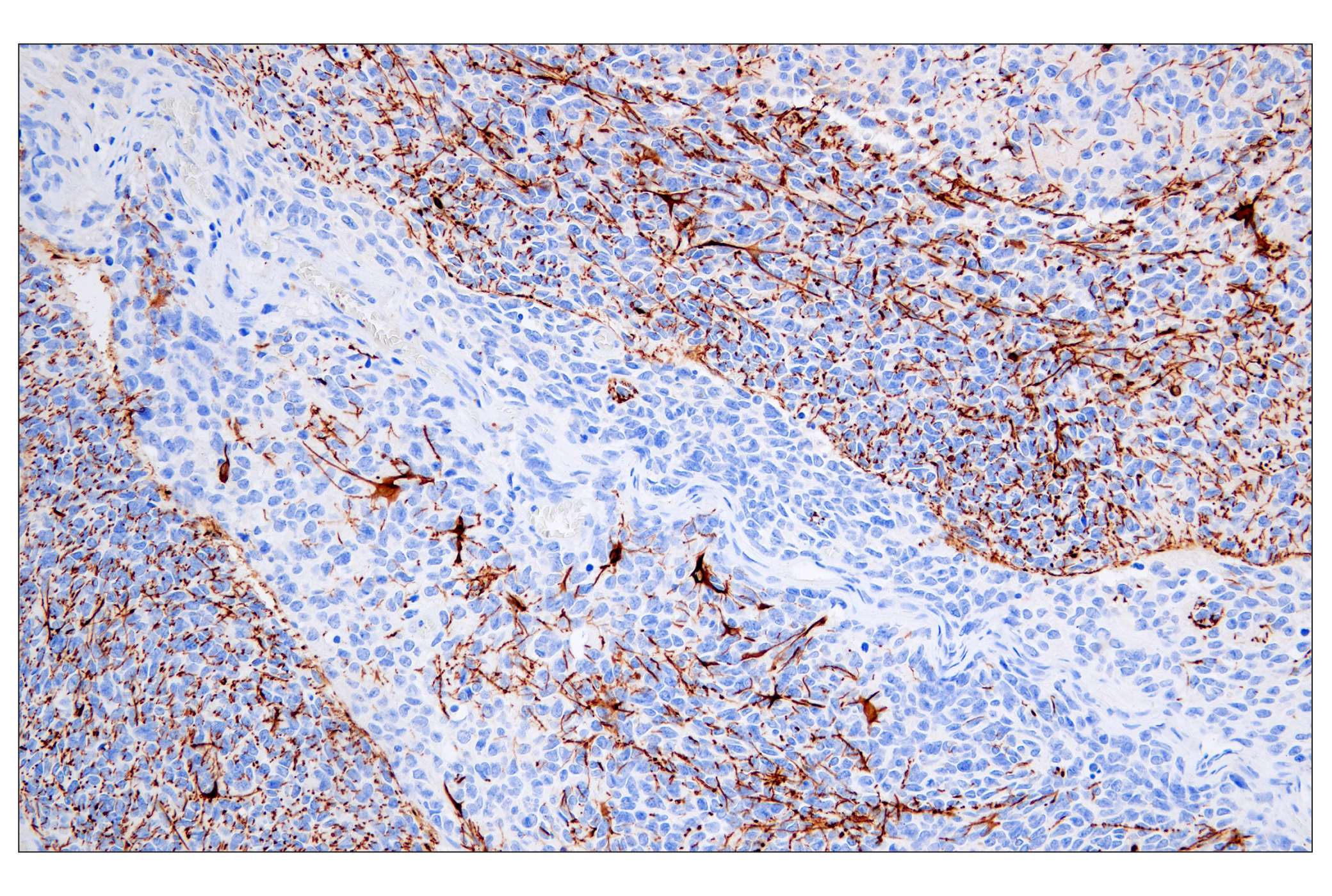  Image 35: Astrocyte Markers Antibody Sampler Kit