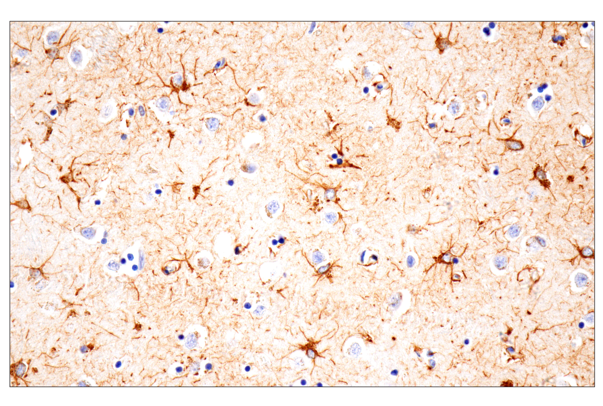  Image 16: Traumatic Brain Injury Biomarker Antibody Sampler Kit