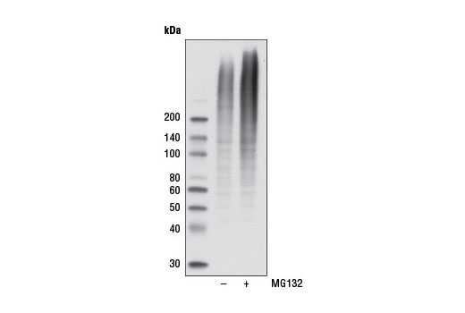 Western Blotting Image 3: K48-linkage Specific Polyubiquitin (D9D5) Rabbit mAb