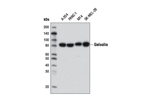 Western Blotting Image 1: Gelsolin Antibody