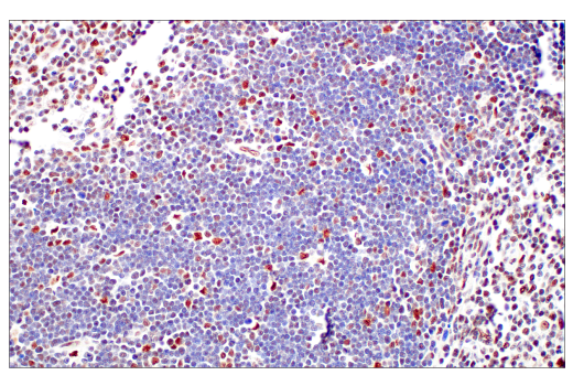 Immunohistochemistry Image 10: p95/NBS1 (E8M3Q) XP® Rabbit mAb