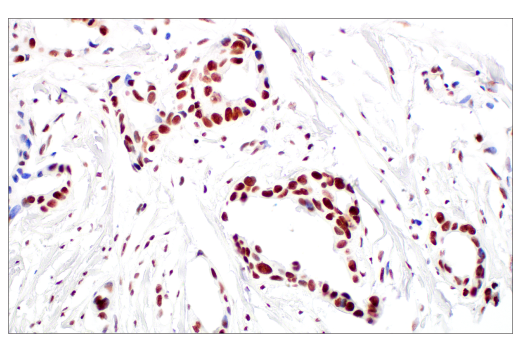 Immunohistochemistry Image 3: p95/NBS1 (E8M3Q) XP® Rabbit mAb