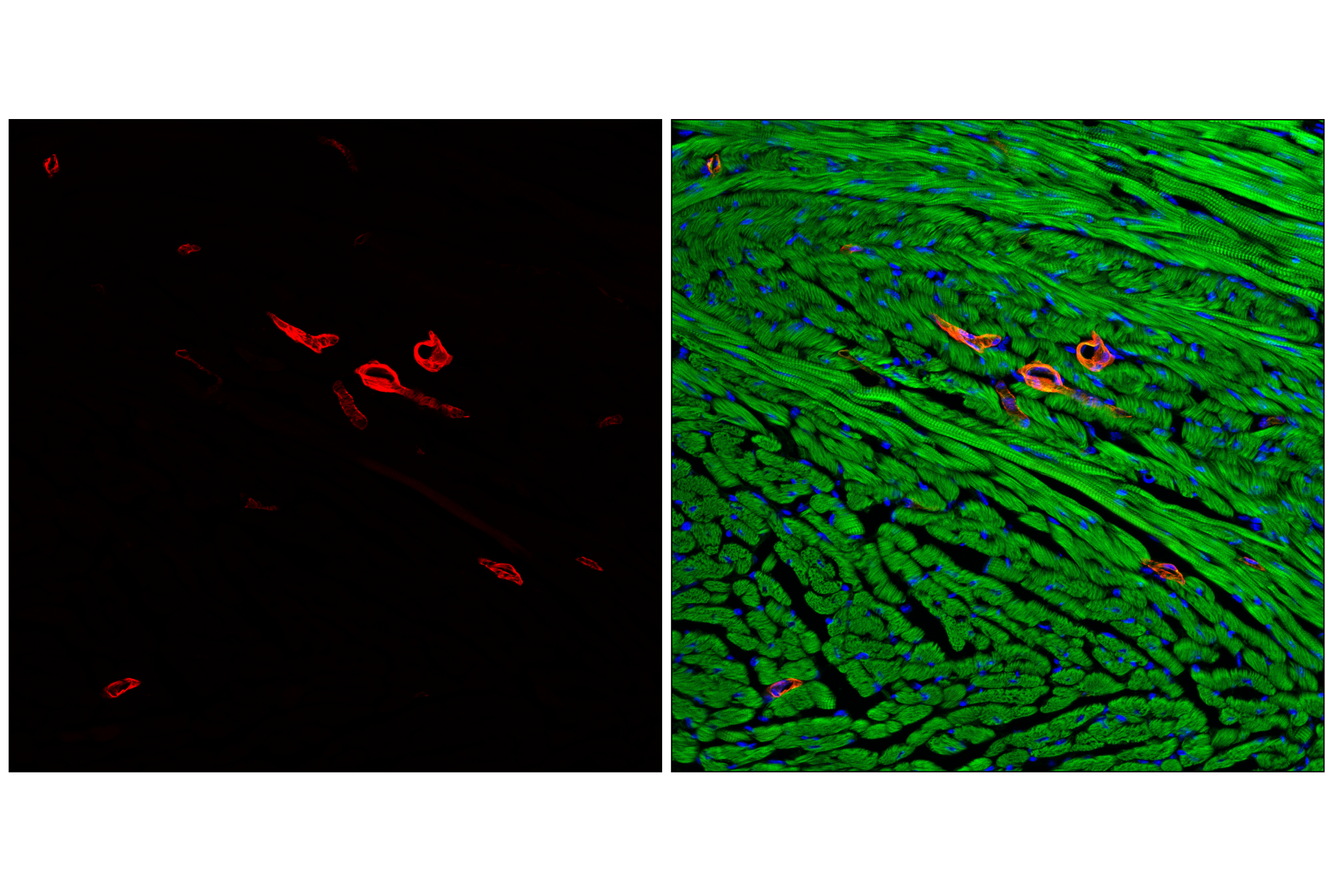 Immunofluorescence Image 1: α-Smooth Muscle Actin (D4K9N) XP® Rabbit mAb (Alexa Fluor® 700 Conjugate)