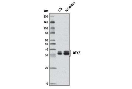 Western Blotting Image 1: OTX2 Antibody