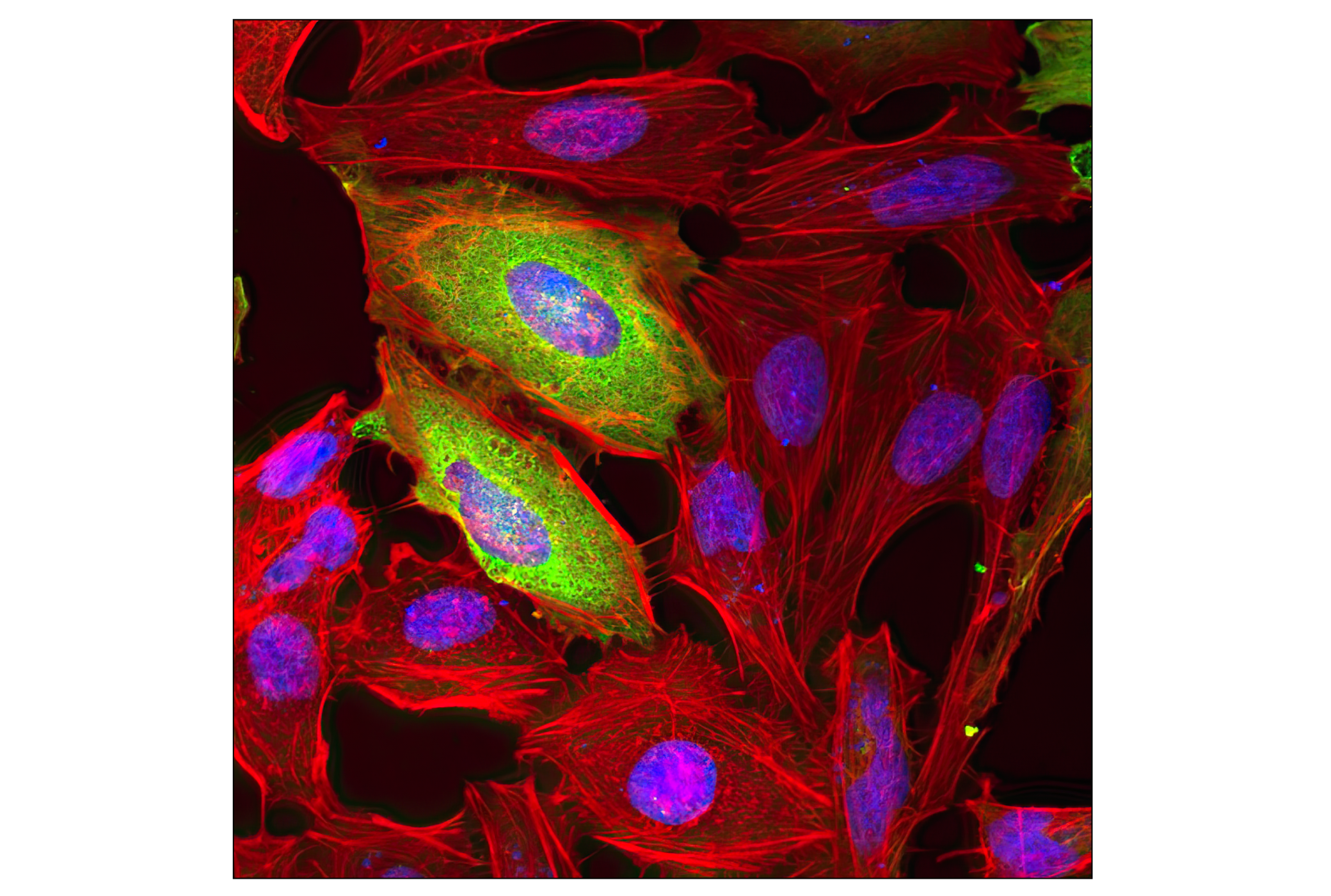 Immunofluorescence Image 1: DYKDDDDK Tag (9A3) Mouse mAb (Binds to same epitope as Sigma-Aldrich Anti-FLAG M2 antibody)