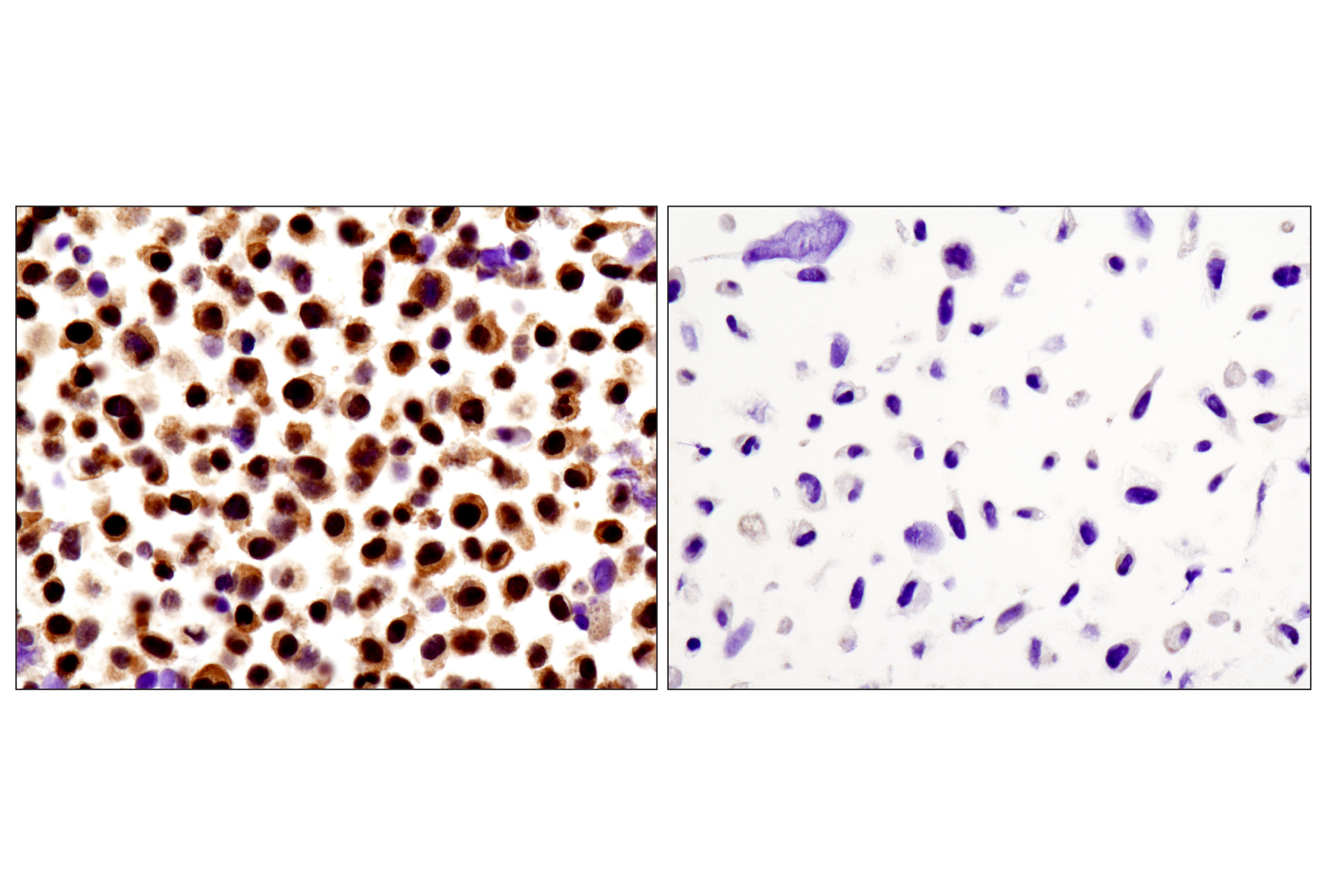 Immunohistochemistry Image 1: Stat3α (D1A5) XP® Rabbit mAb (BSA and Azide Free)