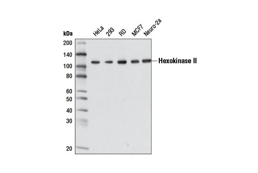 Western Blotting Image 1: Hexokinase II (3D7) Mouse mAb