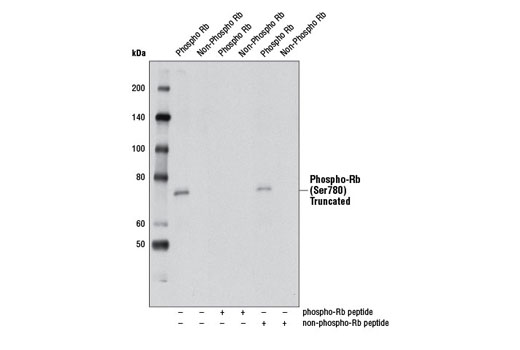 Image 12: PhosphoPlus® Rb (Ser780, Ser807/811) Antibody Kit