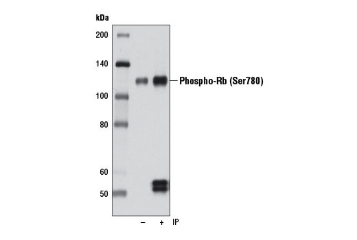 Immunoprecipitation Image 1: Phospho-Rb (Ser780) (D59B7) Rabbit mAb