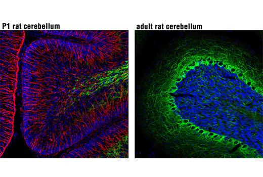Immunofluorescence Image 1: Nestin (Rat-401) Mouse mAb (Alexa Fluor® 555 Conjugate)