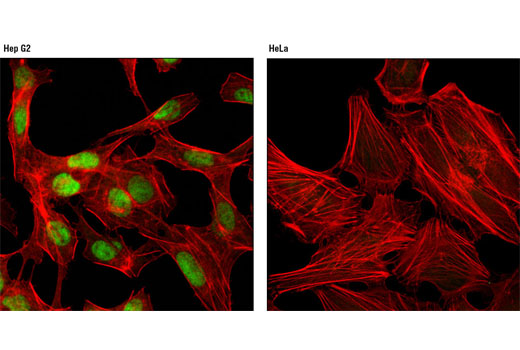 Immunofluorescence Image 1: FoxA2/HNF3β (D56D6) XP® Rabbit mAb