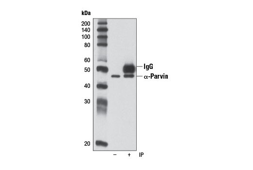 Immunoprecipitation Image 1: α-Parvin (D7F9) XP® Rabbit mAb