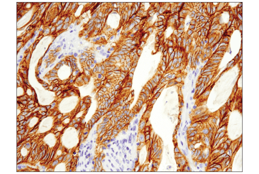  Image 28: Wnt/β-Catenin Activated Targets Antibody Sampler Kit