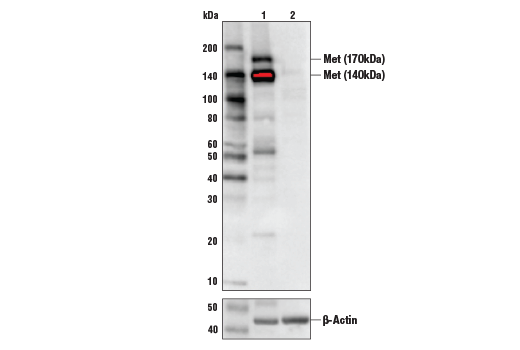 Image 21: Wnt/β-Catenin Activated Targets Antibody Sampler Kit
