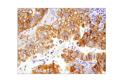  Image 9: PhosphoPlus® Met (Tyr1234/Tyr1235) Antibody Duet