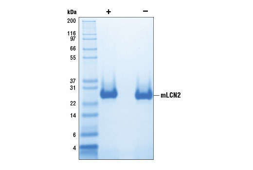  Image 2: Mouse Lipocalin-2 (mLCN2)