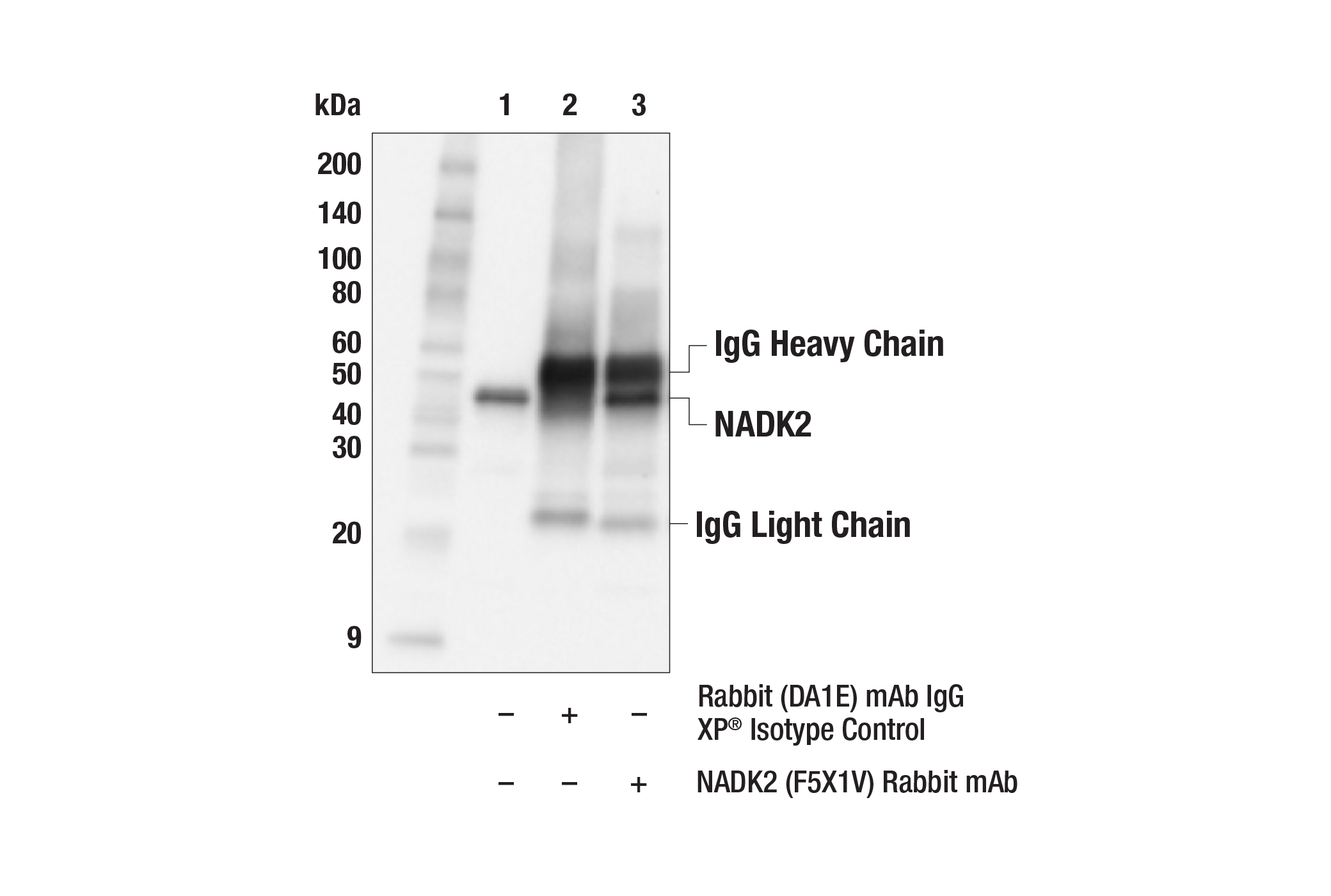 Immunoprecipitation Image 1: NADK2 (F5X1V) Rabbit mAb
