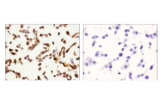 Immunohistochemistry Image 7: VISTA (D1L2G™) XP® Rabbit mAb (BSA and Azide Free)