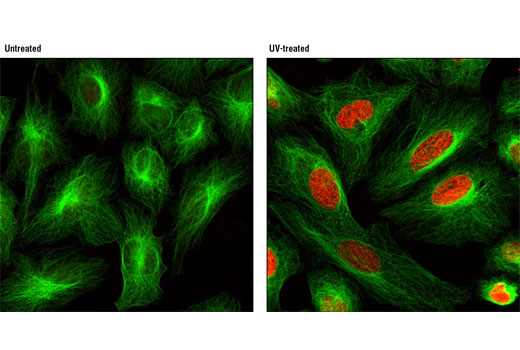 Immunofluorescence Image 1: Phospho-Histone H2A.X (Ser139) (20E3) Rabbit mAb (Alexa Fluor® 555 Conjugate)