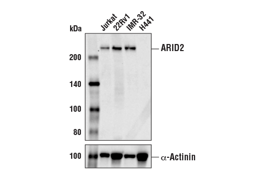  Image 7: PBAF Complex Antibody Sampler Kit