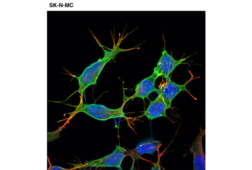 Immunofluorescence Image 1: p75NTR (D4B3) XP® Rabbit mAb (BSA and Azide Free)