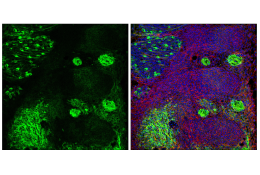 Immunofluorescence Image 2: p75NTR (D4B3) XP® Rabbit mAb