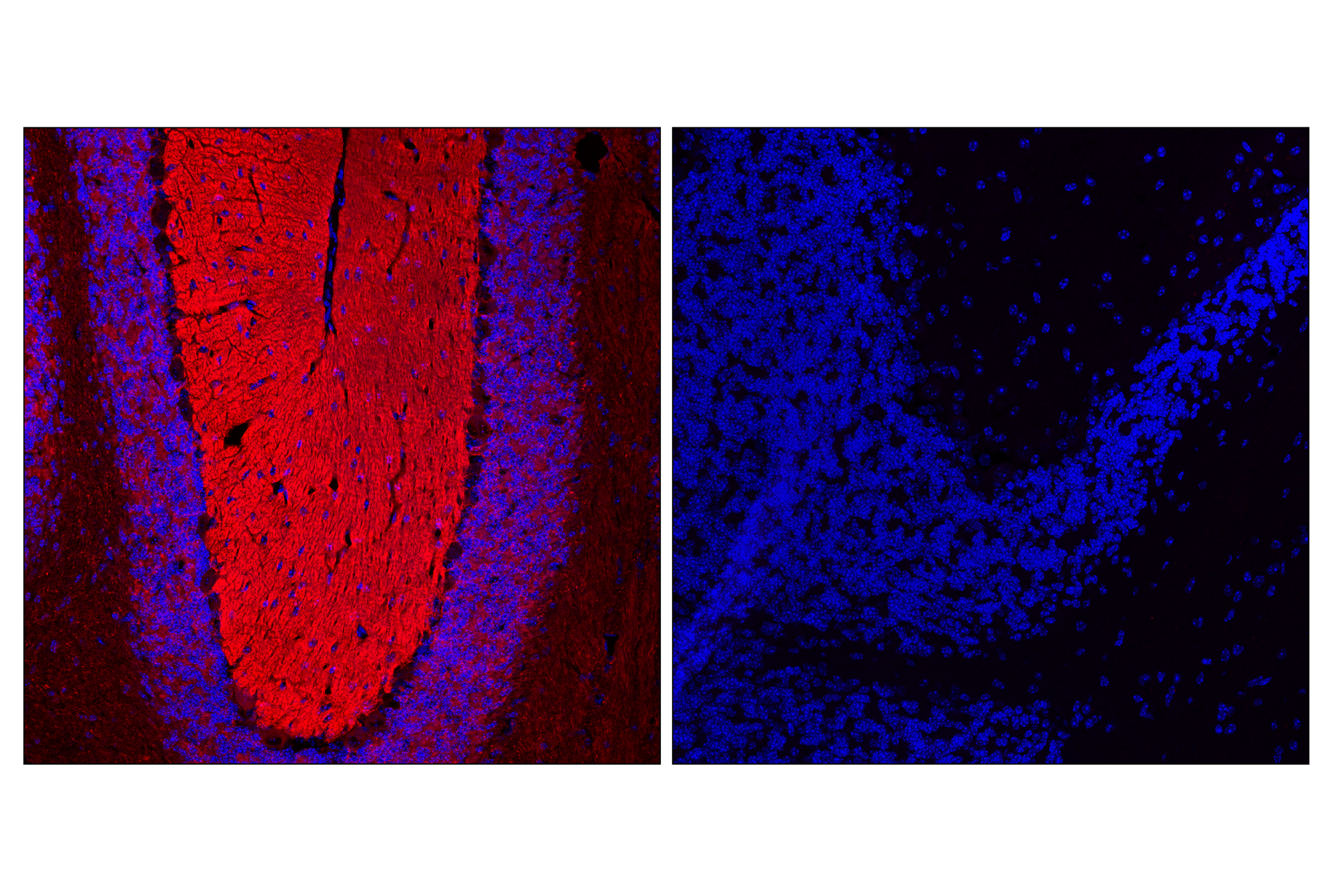 Immunofluorescence Image 1: Tau (E5O2W) Rabbit mAb