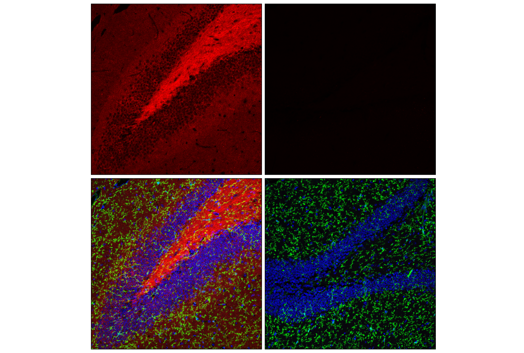 Immunofluorescence Image 2: Tau (E5O2W) Rabbit mAb
