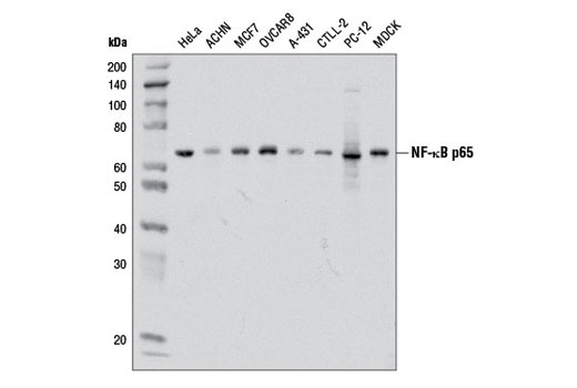  Image 13: NF-κB p65 Antibody Sampler Kit