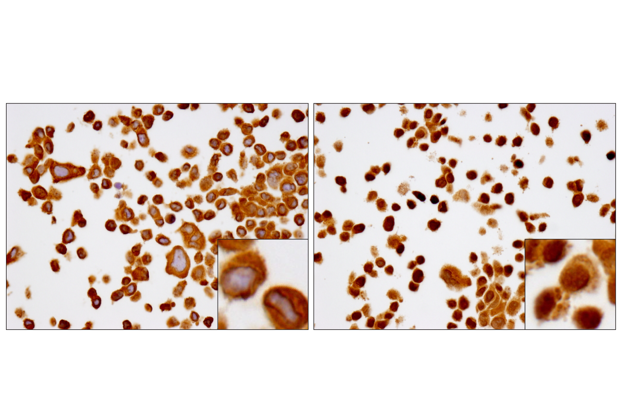  Image 8: PhosphoPlus® NF-κB p65/RelA (Ser536) Antibody Duet