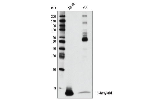  Image 15: β-Amyloid Peptides Antibody Sampler Kit