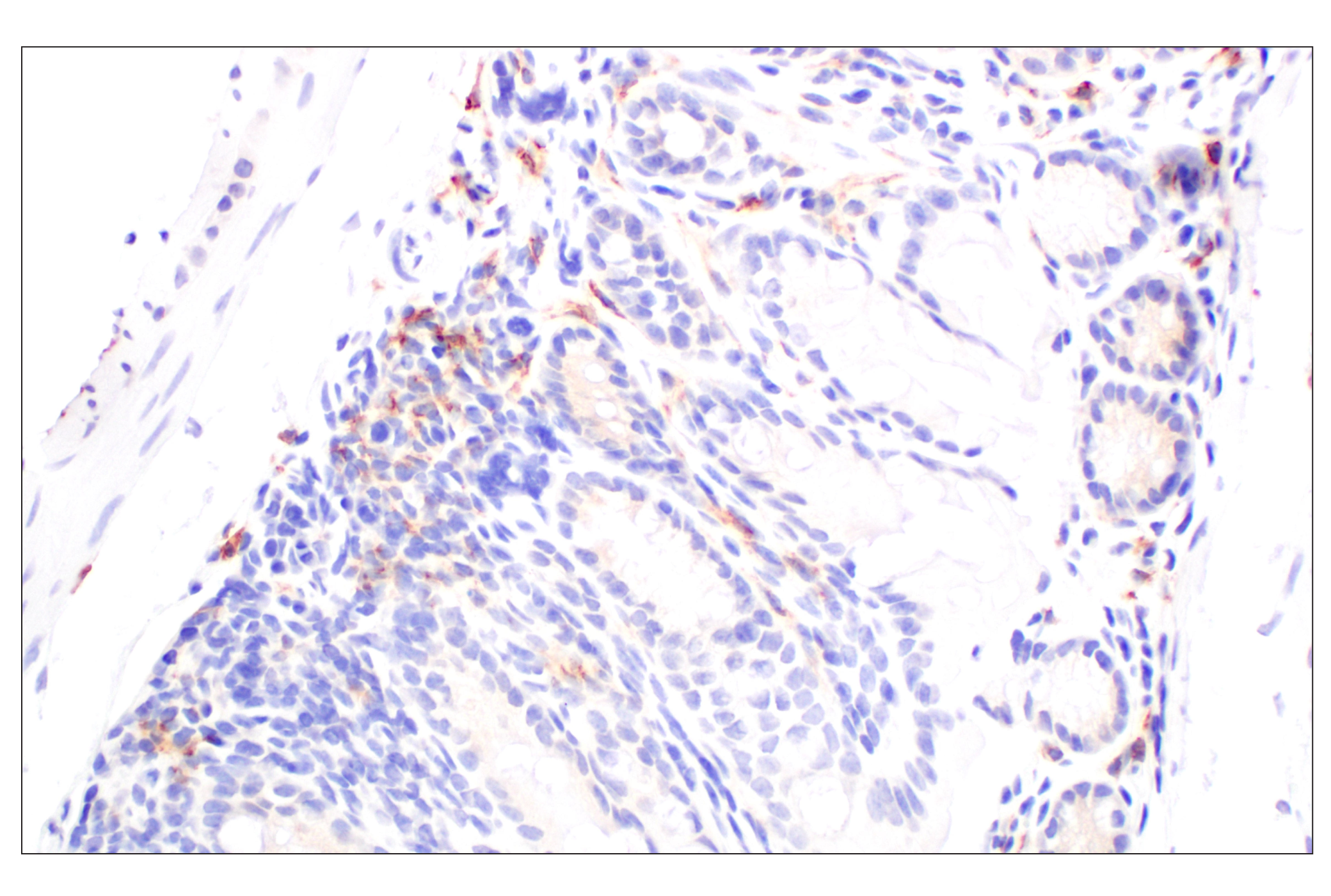 Immunohistochemistry Image 4: Siglec-1/CD169 (E1D7G) Rabbit mAb