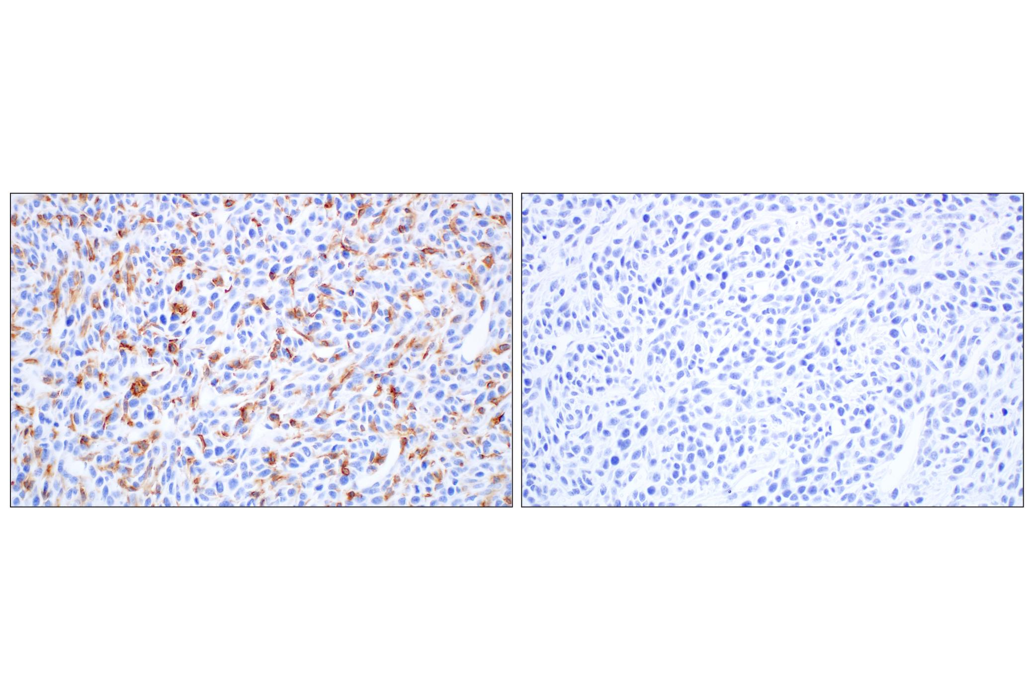 Immunohistochemistry Image 8: Siglec-1/CD169 (E1D7G) Rabbit mAb