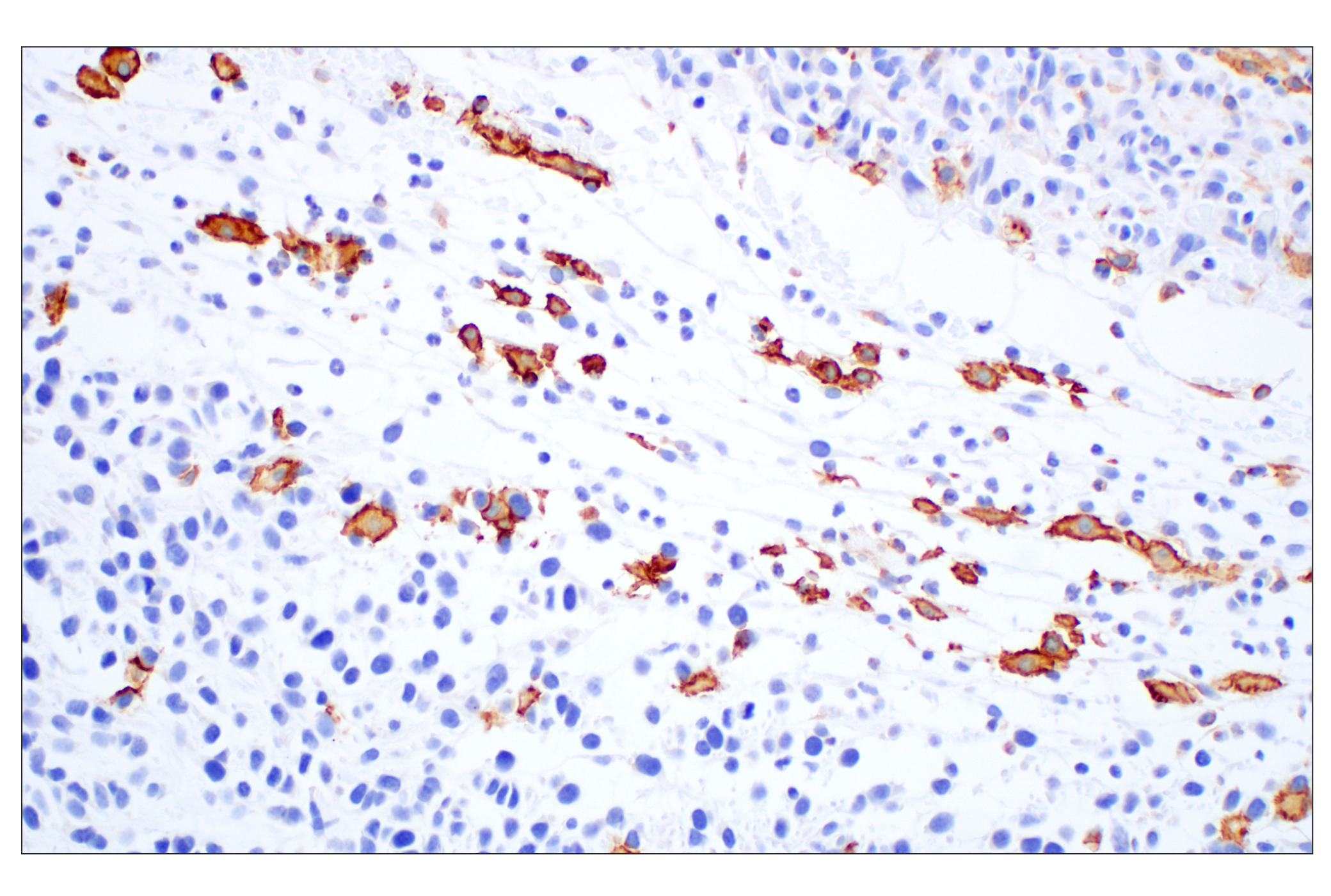 Immunohistochemistry Image 1: Siglec-1/CD169 (E1D7G) Rabbit mAb
