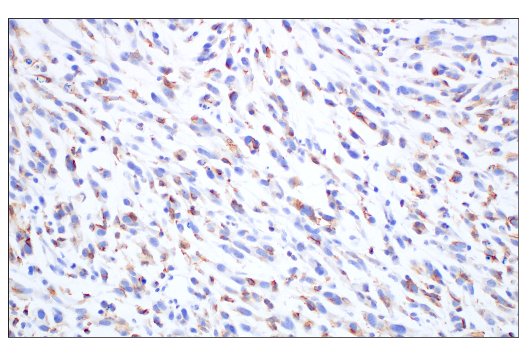 Immunohistochemistry Image 2: Siglec-1/CD169 (E1D7G) Rabbit mAb