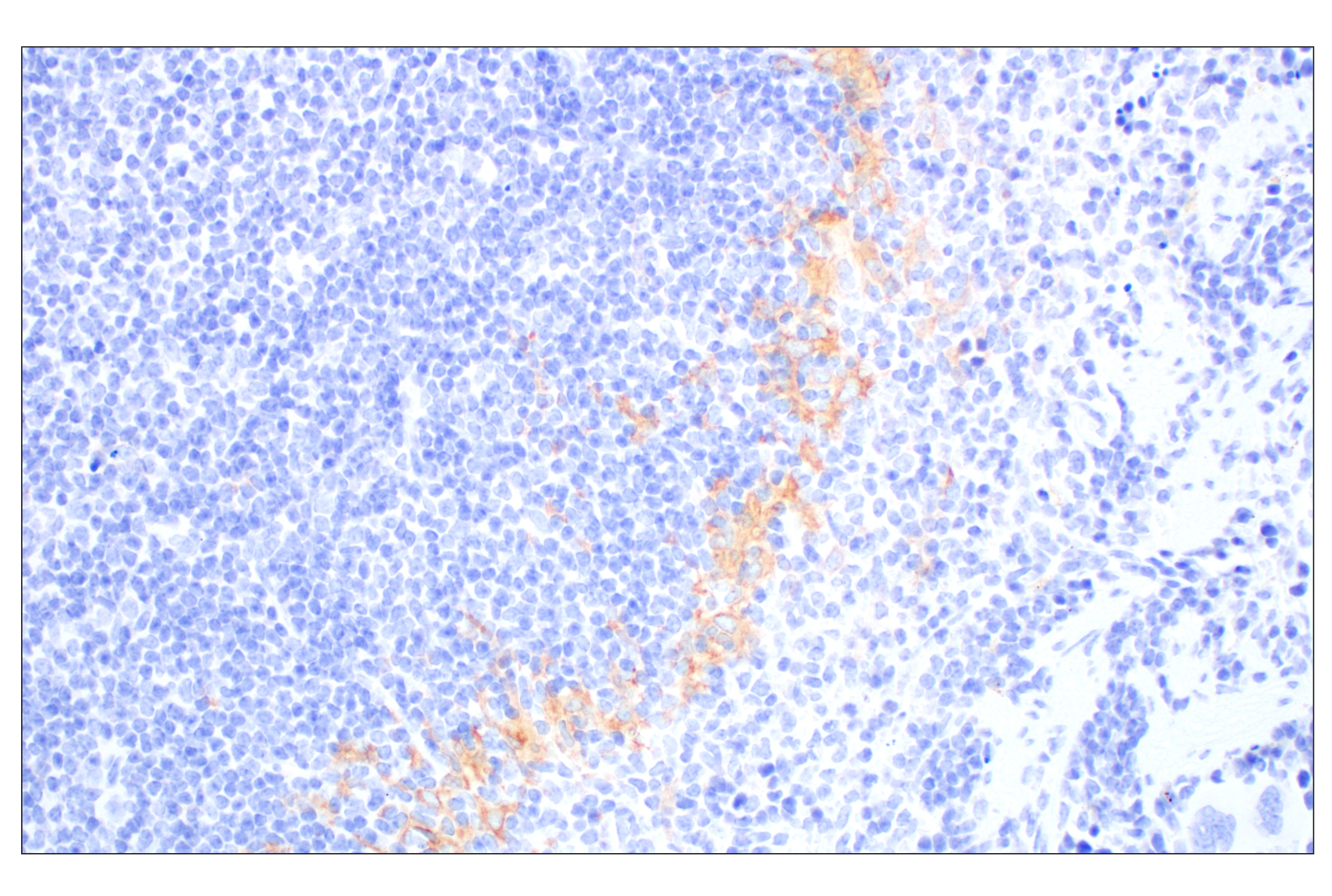 Immunohistochemistry Image 6: Siglec-1/CD169 (E1D7G) Rabbit mAb