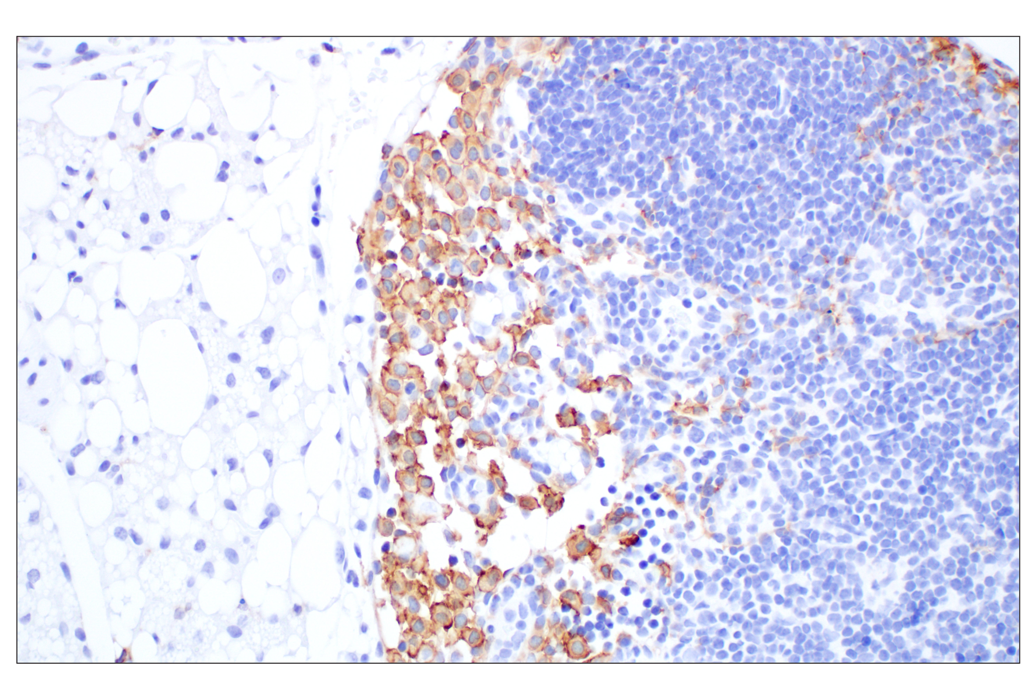 Immunohistochemistry Image 3: Siglec-1/CD169 (E1D7G) Rabbit mAb