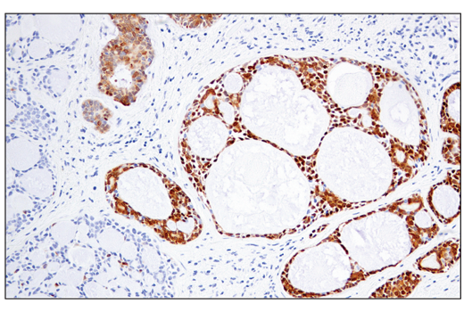 Immunohistochemistry Image 1: MAGE-A4 (E7O1U) XP® Rabbit mAb