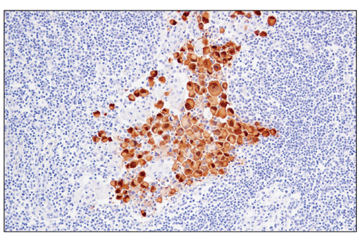 Immunohistochemistry Image 2: MAGE-A4 (E7O1U) XP® Rabbit mAb