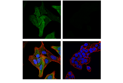 Immunofluorescence Image 1: MAGE-A4 (E7O1U) XP® Rabbit mAb
