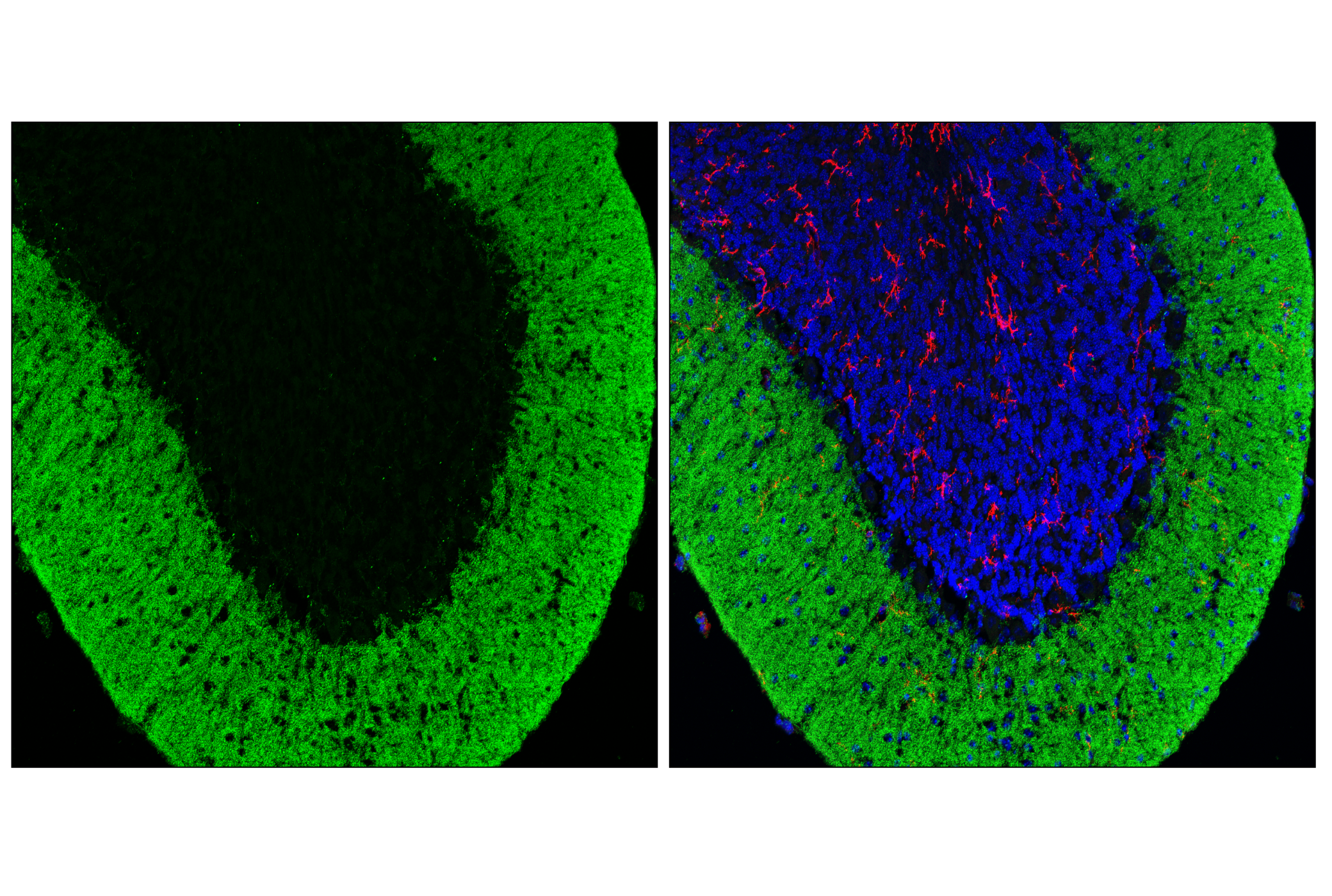 Immunofluorescence Image 1: SHANK2 (E2J1N) Rabbit mAb