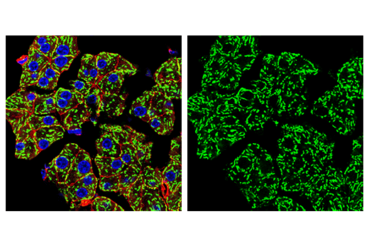 Immunofluorescence Image 3: MAVS (E8Z7M) Rabbit mAb