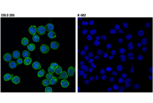 Immunofluorescence Image 1: EphB2 (D2X2I) Rabbit mAb