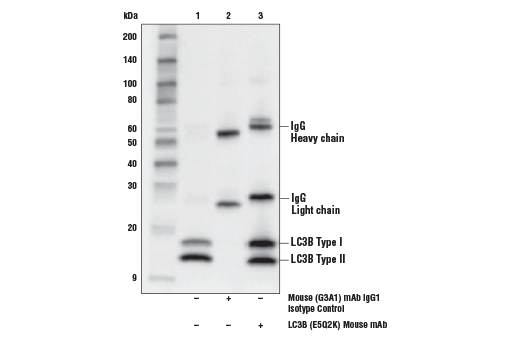 Immunoprecipitation Image 1: LC3B (E5Q2K) Mouse mAb
