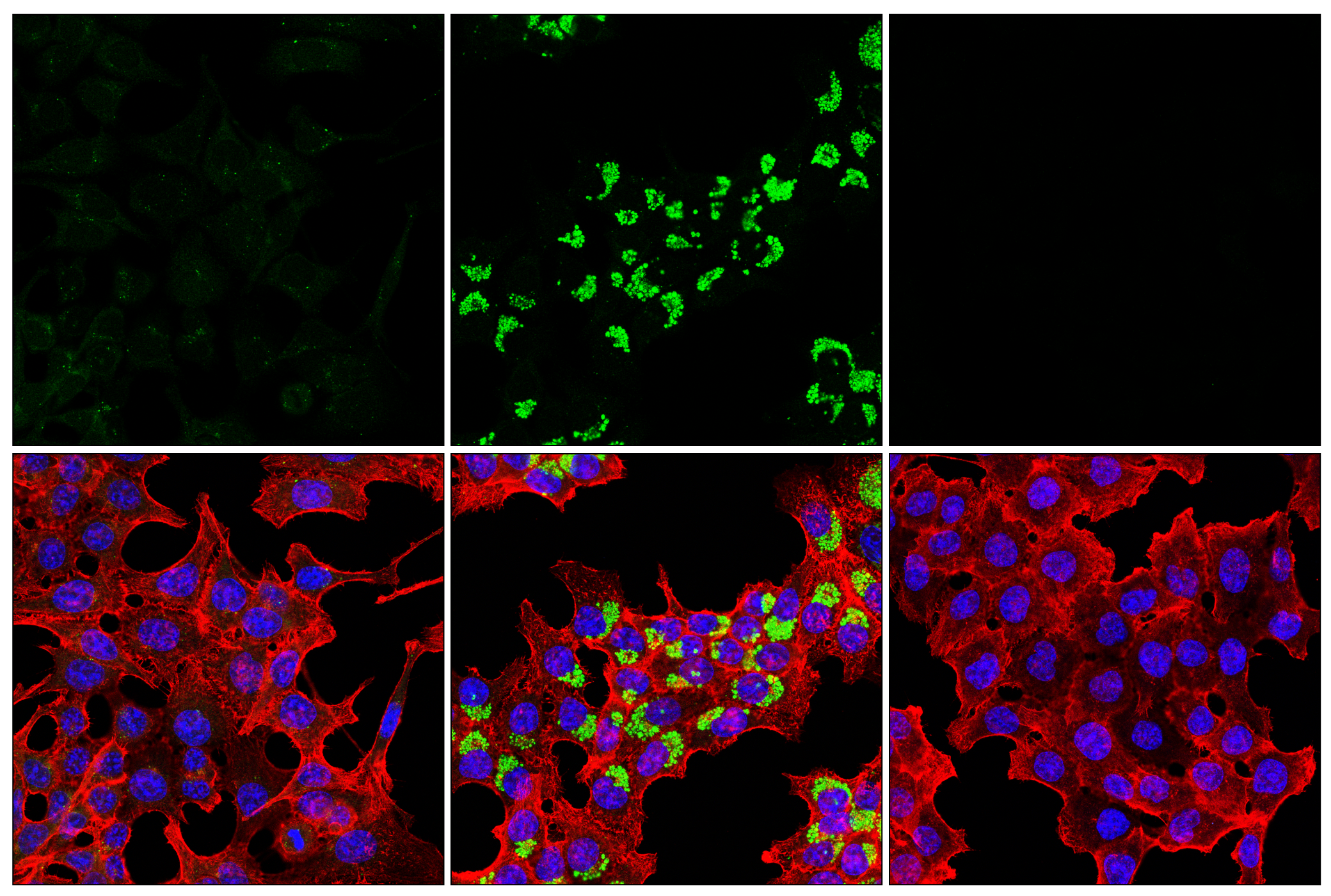 Immunofluorescence Image 3: LC3B (E5Q2K) Mouse mAb