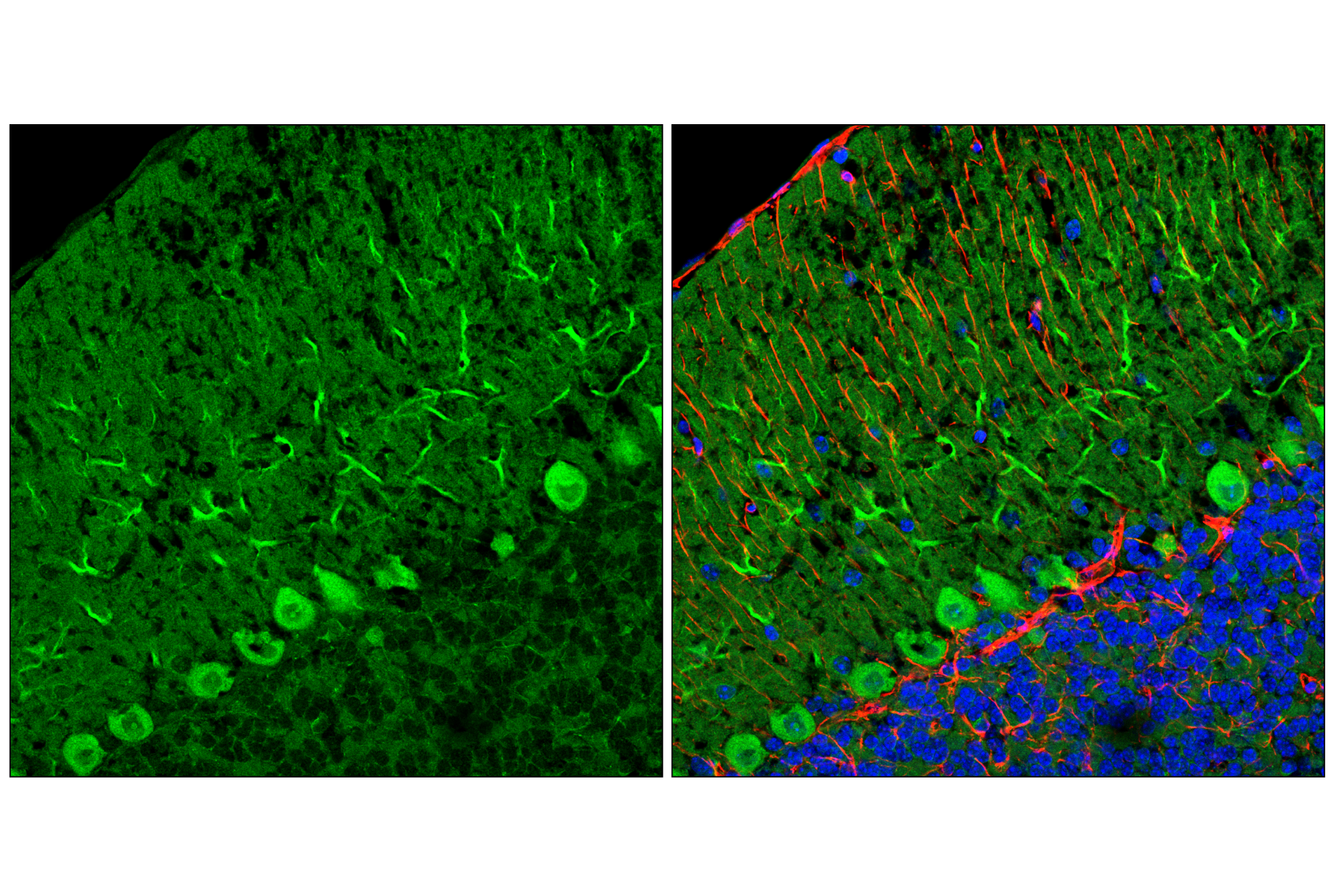 Immunofluorescence Image 1: LC3B (E5Q2K) Mouse mAb