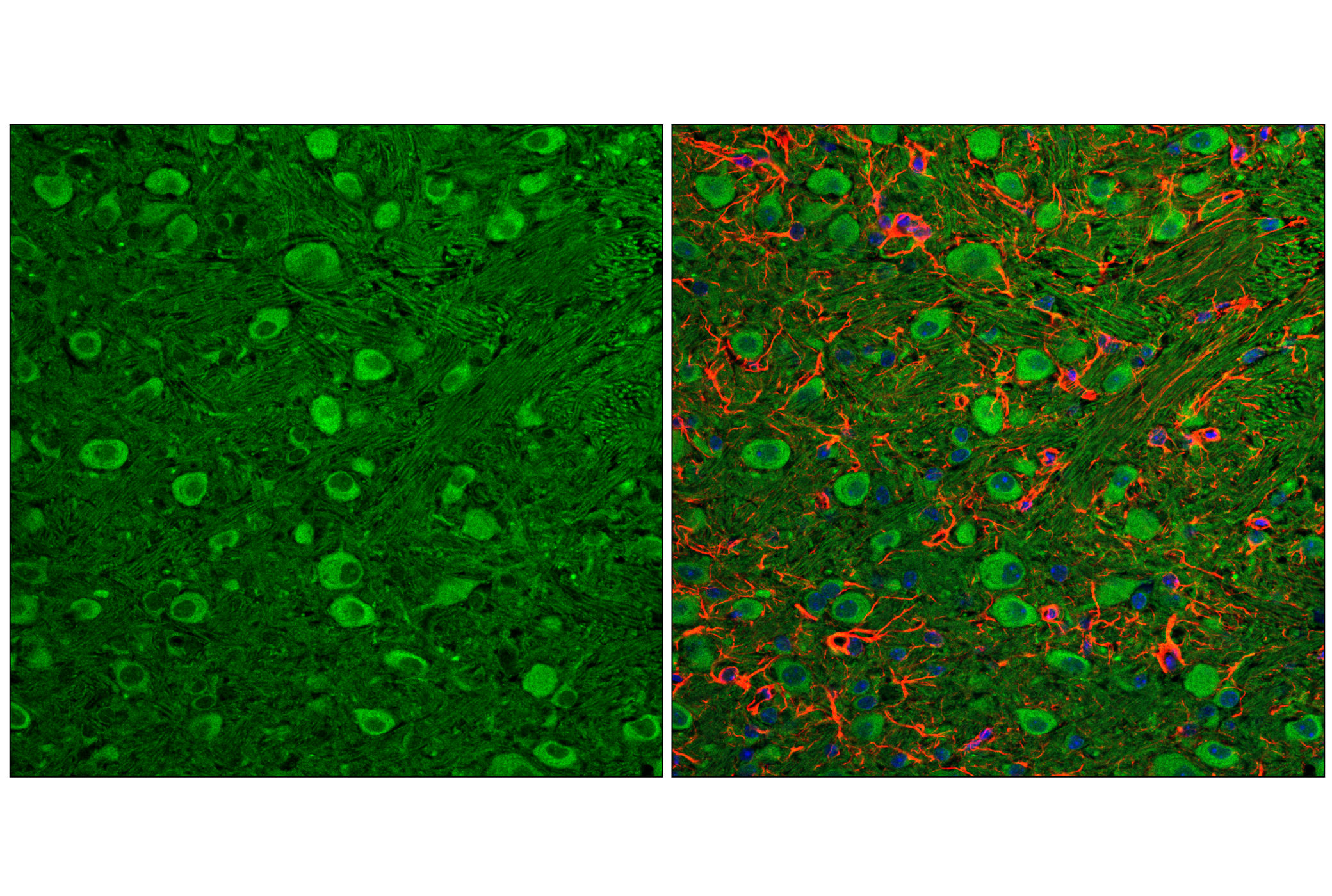 Immunofluorescence Image 2: LC3B (E5Q2K) Mouse mAb